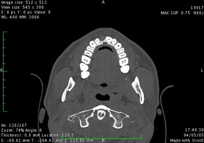 Image4 vfgrxh - Eugenol