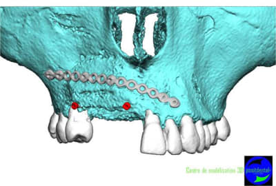 Image4 ydwnyw - Eugenol