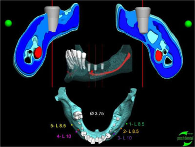 Image5 npmqlo - Eugenol