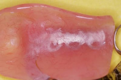 Image6 absoug - Eugenol