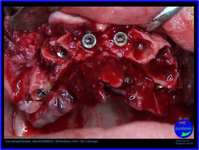 Image6 ymphpa - Eugenol