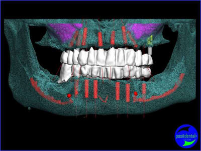 Image7 wid0sf - Eugenol