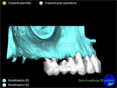 Image8 ruoind - Eugenol