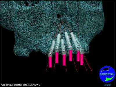 Image8 sy1wfq - Eugenol