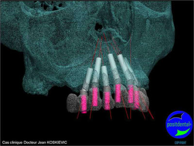 Image9 fmwwan - Eugenol