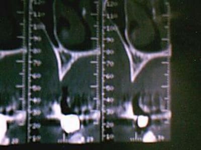 Image 002 brrbyi - Eugenol