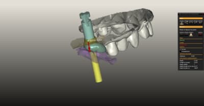 Image zzkcct - Eugenol