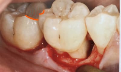 Inkedd81mtvc4zhd17sf6tbk8 li p8narr - Eugenol