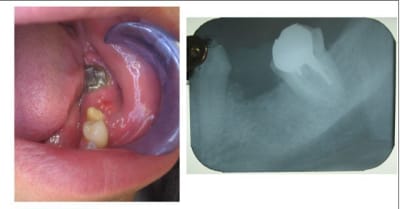 Inter trop matisant ljnvir - Eugenol