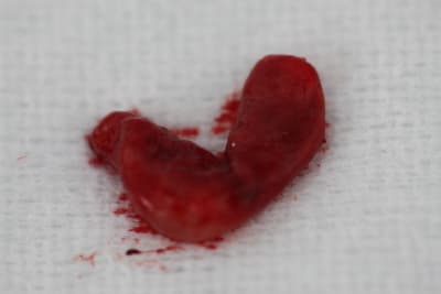 Jou 124 lcrwmc - Eugenol