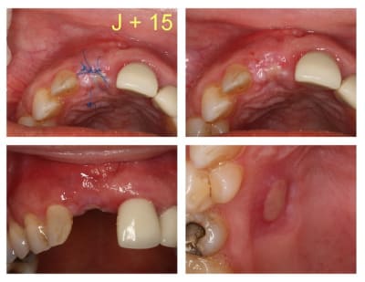 J 15 o4urtu - Eugenol