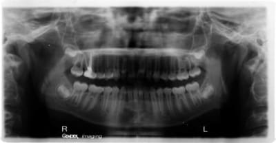 L1 nqke5f - Eugenol