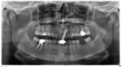 Labastie j 20130703 864 hqgknv - Eugenol