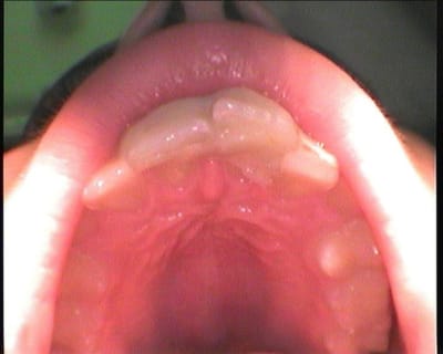 Leo3 cqtjgi - Eugenol