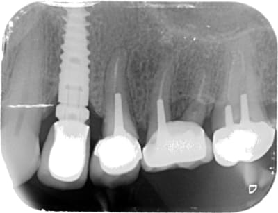 Lii ifikfh - Eugenol