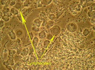 Lympho ofq9ra - Eugenol