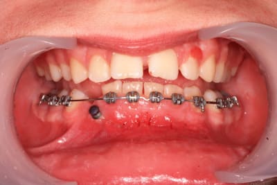 L jean baptiste 2 y6j8ah - Eugenol