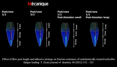 La dent pulp e 2015 rsleqg - Eugenol