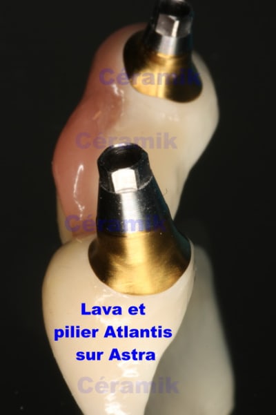 Lava astra atlantis xlscs1 - Eugenol