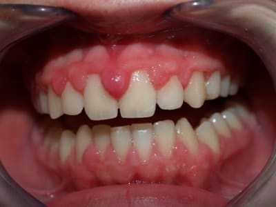 M1115782 xuhy97 - Eugenol