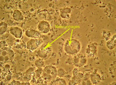 Macrophages whxg0y - Eugenol