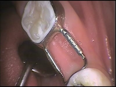 Mainteneur oppac0 - Eugenol