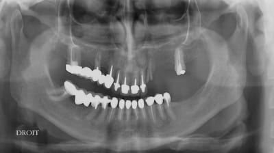 Man j f20.02 - Eugenol