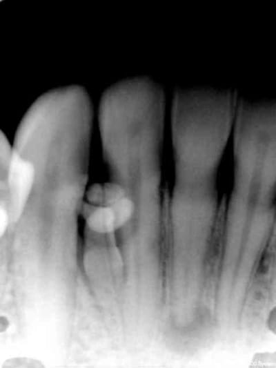 Mary cxgbem - Eugenol