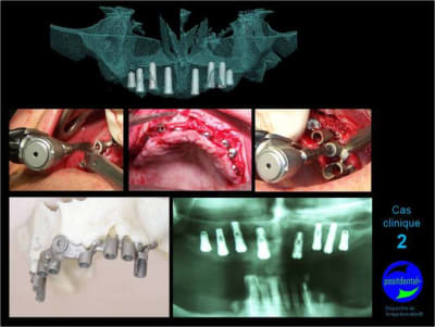 Mcd mise en charge diff r e03 ogd9en - Eugenol