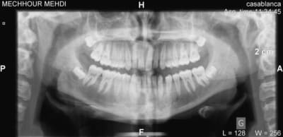 Mechhour mehdi dx 20090715 113218 2 frojj9 - Eugenol