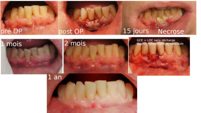 Mm - Eugenol