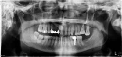 Mme ossard b9pjow - Eugenol