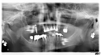 Mme x2 xi3esh - Eugenol