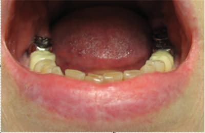 Mme w quzenu - Eugenol