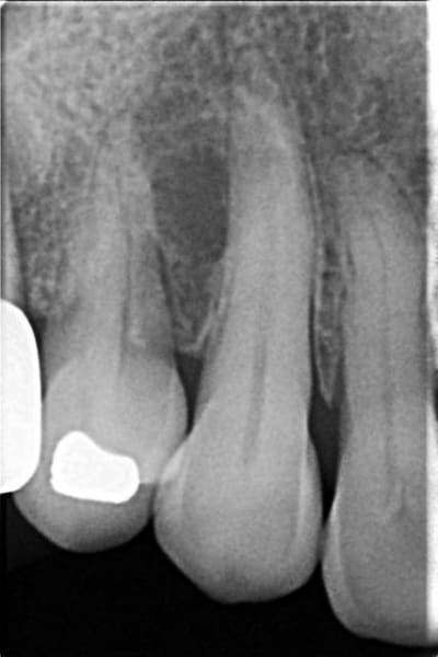 Mo13 che0fn - Eugenol