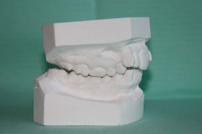 Moulage 3 kvumyd - Eugenol