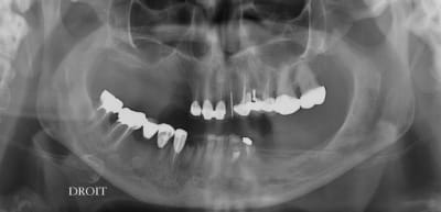 Mo mar08.03 - Eugenol