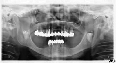 Martine z2kfpe - Eugenol