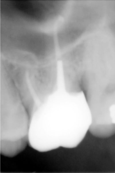 Maz 3 mxvuqo - Eugenol