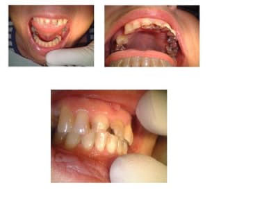 Metruc y326as - Eugenol