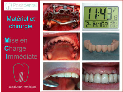 Mise en charge immédiate 009 stcitf - Eugenol