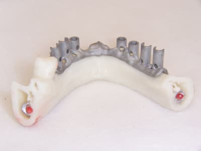 Mise en charge imm diate 026 mmmsth - Eugenol