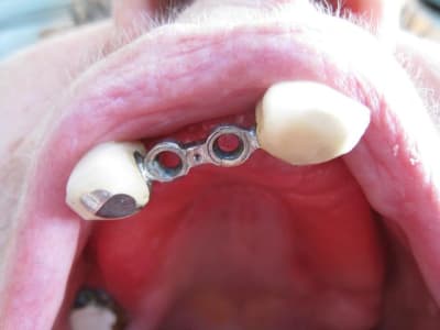 Mme g attachements ksemfs - Eugenol