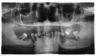 Nagau r 20050310 1482 yx5m2m - Eugenol