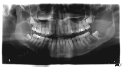 Opg initial fvtvt0 - Eugenol