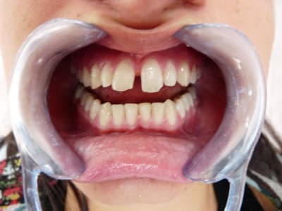 P1000260 dxrbd0 - Eugenol