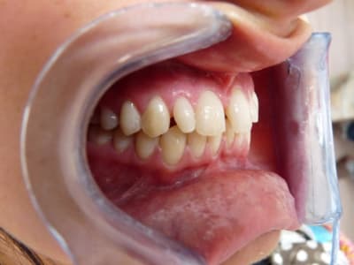 P1000262 k9zi98 - Eugenol