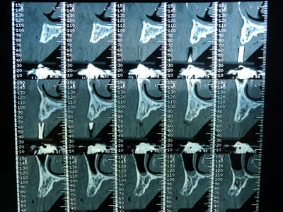 P1050004 ahuu53 - Eugenol