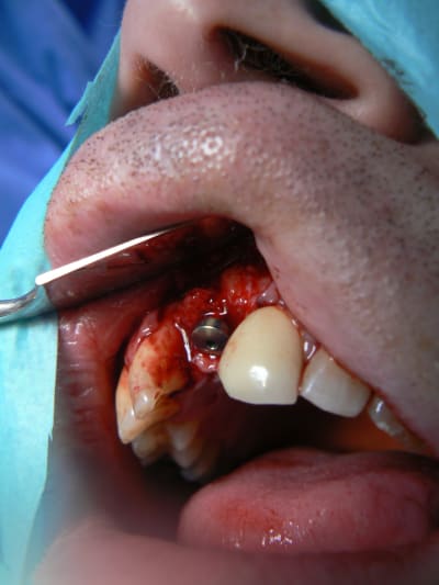 P1090043 yp3dfd - Eugenol