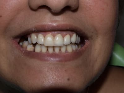 P2210708 srkfvd - Eugenol